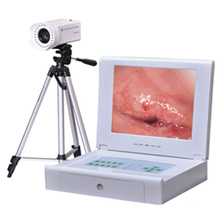 Colposcope numérique portable professionnel de vente chaude intelligemment